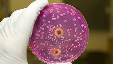 Ерлердегі патологиялық разрядтар